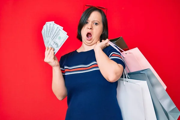 Mulher Morena Com Síndrome Segurando Sacos Compras Dólares Face Choque — Fotografia de Stock