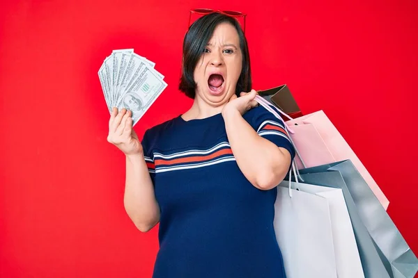 Mulher Morena Com Síndrome Segurando Sacos Compras Dólares Irritado Louco — Fotografia de Stock