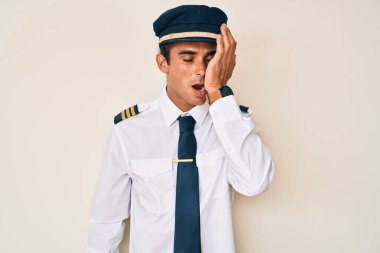 Uçak pilotu üniforması giyen İspanyol genç adam, yarı yüz, göz ve ağız kısmını eliyle kapatmaktan yoruldu. Yüzüm acıyor.. 