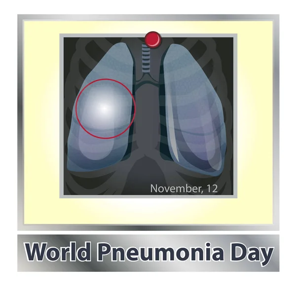 Doença pulmonar simbólica. Respiração. Sistema respiratório. Doença respiratória - asma de cancro, tuberculose, pneumonia. Dia Mundial da Pneumonia. Saúde. Radiografia dos pulmões — Vetor de Stock