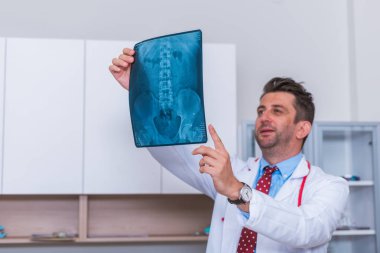 Male Doctor in his mid 40's reading an x-ray image ( radiography clipart