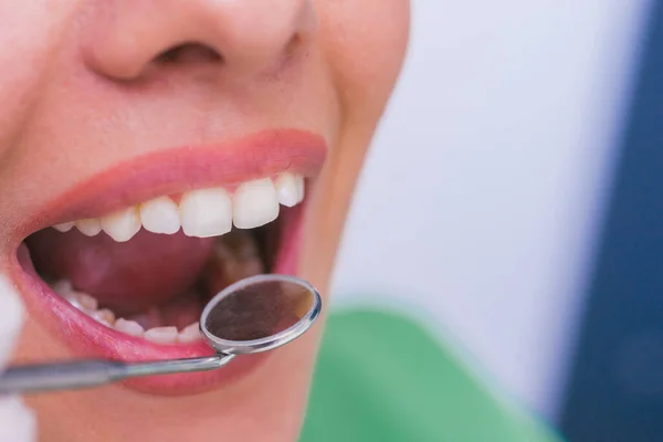 在牙科医生进行口腔检查时 用张开的嘴对一名女病人进行检查 — 图库照片