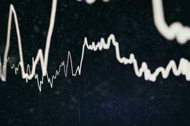 İş grafik arka planı: analiz iş muhasebe bilgi levhalar üzerinde. İşadamı el altın piyasa, Forex piyasası ve ticaret pazarı için yatırım grafikleri analiz üzerinde çalışma.