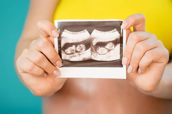 Γκρο πλαν αγνώριστος έγκυος γυναίκα κρατώντας υπερηχογράφημα στο υπόβαθρο της κοιλιάς. Μητρότητας, εγκυμοσύνη, αγάπη, μητρότητα, δίδυμα έννοια. — Φωτογραφία Αρχείου