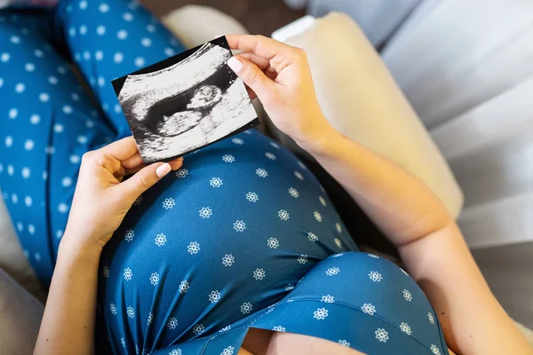 Αγνώριστος έγκυος γυναίκα κρατώντας υπερηχογράφημα βολή. — Φωτογραφία Αρχείου
