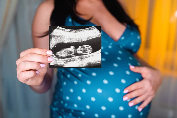 Αγνώριστος έγκυος γυναίκα κρατώντας υπερηχογράφημα βολή. — Φωτογραφία Αρχείου