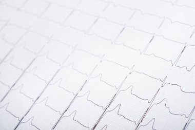 ECG kardiyogram nabız grafiğinin yakın plan fotoğrafı. Tıbbi nabız çizgisi kalp.