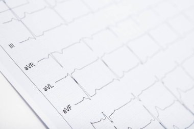 ECG kardiyogram nabız grafiğinin yakın plan fotoğrafı. Tıbbi nabız çizgisi kalp.