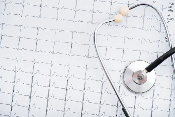 医疗听诊器和电针的结果就像一个图表 心脏情况的图形 心脏病的诊断 — 图库照片