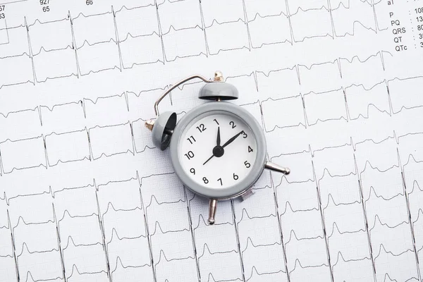 心臓の状態を確認する時間 心臓発作などの疾患の診断 — ストック写真