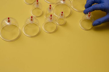 Hijama için kavanozlar. Sarı arkaplandaki süpürge pompaları