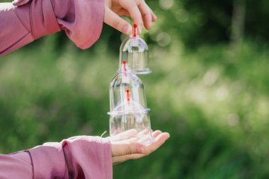 Kız hijama için bir kavanoz tutuyor. Hijama, kan dökme, sunna tedavisi. Ağaçların ve yeşilliklerin arka planına karşı kan akıtmak için kavanozlar.