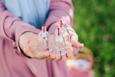 Kız hijama için bir kavanoz tutuyor. Hijama, kan dökme, sunna tedavisi. Ağaçların ve yeşilliklerin arka planına karşı kan akıtmak için kavanozlar.