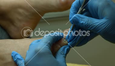 Mesleği doktor. Ana, paramedikal pedikür çalışmalarını.