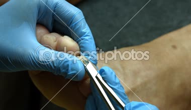 Mesleği doktor. Ana, paramedikal pedikür çalışmalarını.