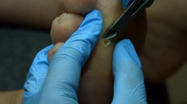 Mesleği doktor. Ana, paramedikal pedikür çalışmalarını.