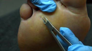 Mesleği doktor. Ana, paramedikal pedikür çalışmalarını.