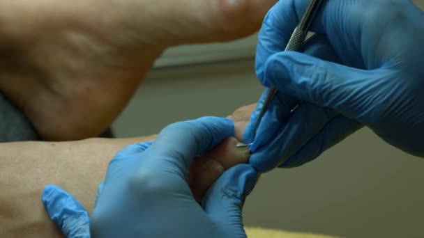 Médico Profissão Trabalho Mestre Pedicure Paramédico — Vídeo de Stock