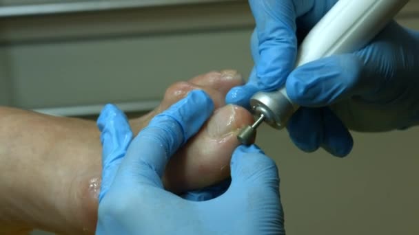 Médico Profesión Trabajo Del Maestro Pedicura Paramédica — Vídeo de stock