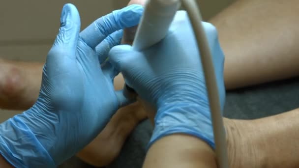 职业医生 大师的工作 辅助医疗修脚 — 图库视频影像