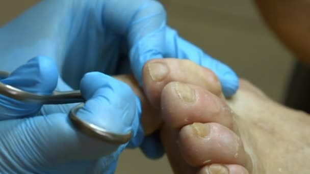 Médico Profesión Trabajo Del Maestro Pedicura Paramédica — Vídeos de Stock