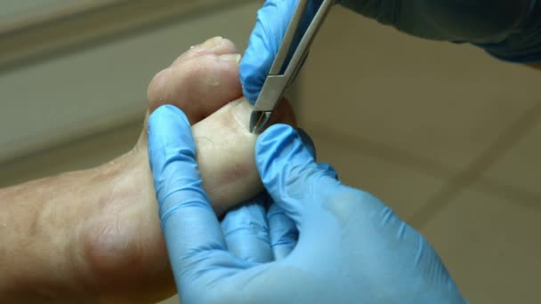 职业医生 大师的工作 辅助医疗修脚 — 图库视频影像