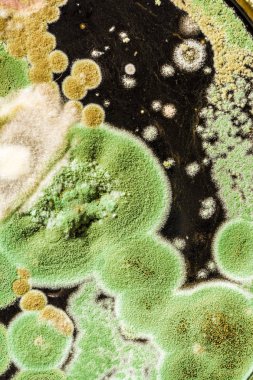 yeşil küf ve siyah arka plan, microbiolog mantar doku