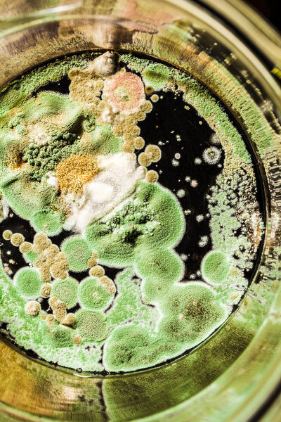 texture of green mold and fungi on black background, microbiolog