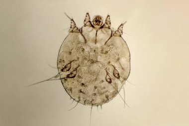 itch-mite, parasitic microorganism of human skin clipart