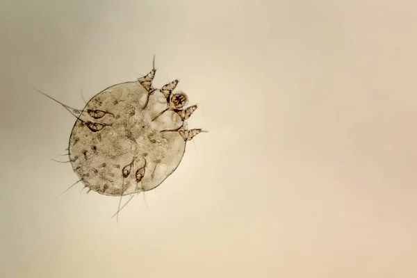 Itch-mite, micro-organisme parasite de la peau humaine — Photo