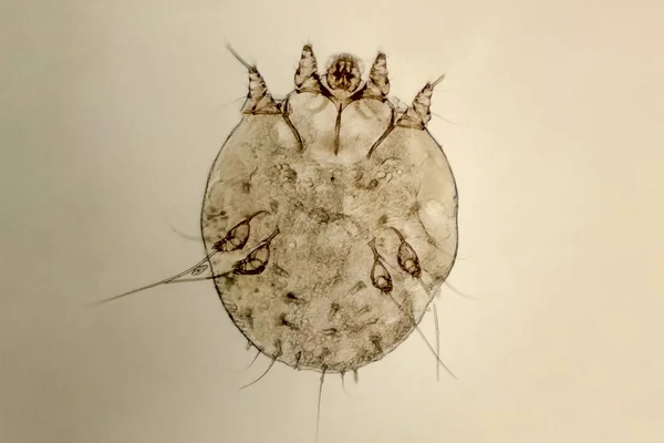 Kaşıntı-mite, insan derisi parazitik mikroorganizma — Stok fotoğraf