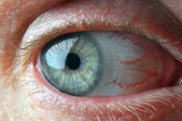 Μάτια Άνθρωπος Τους Φακούς Επαφής Και Τριχοειδή Αίματος Μακροεντολή Γυρίστηκε — Φωτογραφία Αρχείου