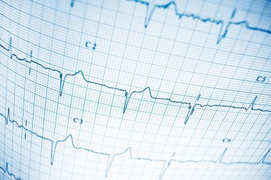 Elektrokardiyogramı kağıt formunda kapat.