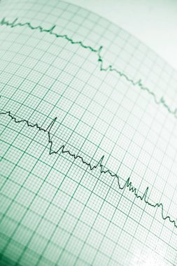 Elektrokardiyogramı kağıt formunda kapat.