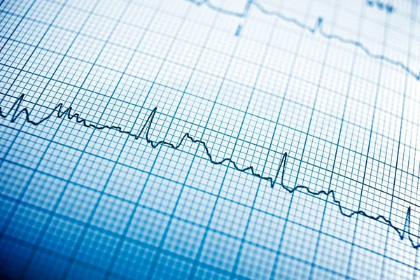 형태로 심전도를 — 스톡 사진