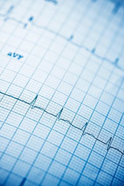 Elektrokardiyogramı kağıt formunda kapat.