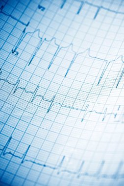 Elektrokardiyogramı kağıt formunda kapat.