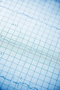 Elektrokardiyogramı kağıt formunda kapat.