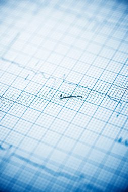 Elektrokardiyogramı kağıt formunda kapat.