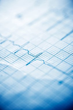 Elektrokardiyogramı kağıt formunda kapat.