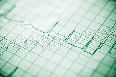 Elektrokardiyogramı kağıt formunda kapat.