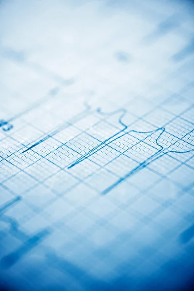 Primer Plano Electrocardiograma Forma Papel —  Fotos de Stock