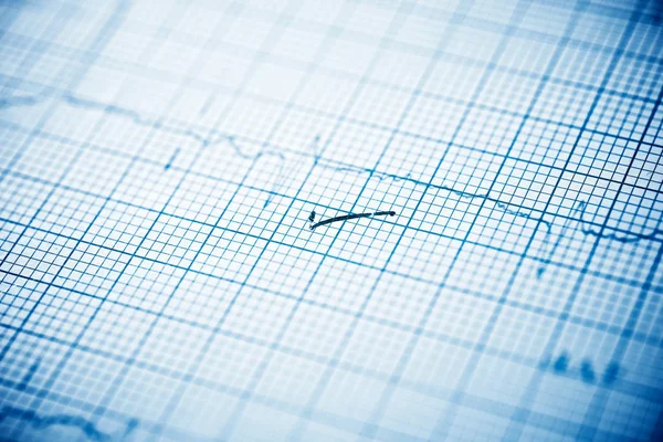 Close Electrocardiogram Paper Form — Stock Photo, Image