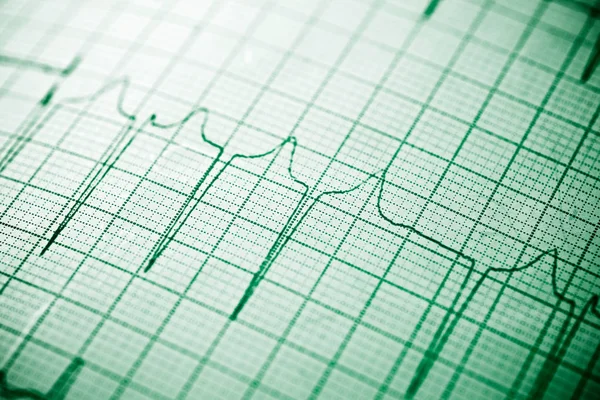 Primer Plano Electrocardiograma Forma Papel —  Fotos de Stock