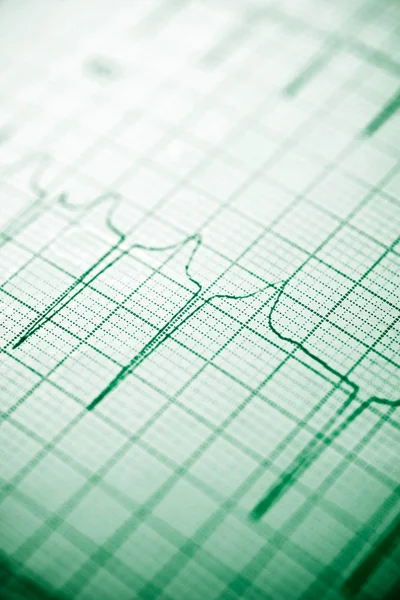 Gros Plan Électrocardiogramme Sur Papier — Photo