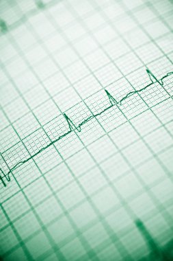 Elektrokardiyogram yakın çekim