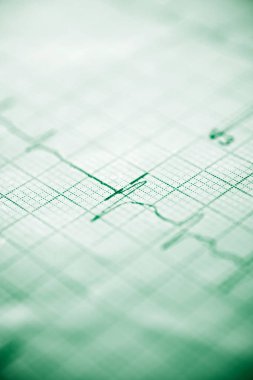 Elektrokardiyogram yakın çekim