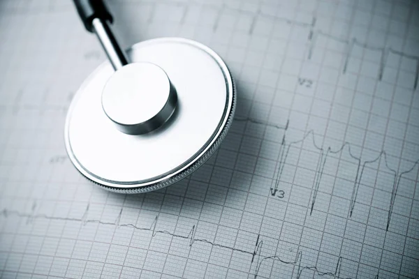 Elektrokardiogramm und Stethoskop — Stockfoto