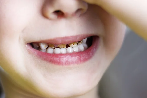 Bambina Sulla Sedia Dal Dentista Mani Chiudono Gli Occhi Denti — Foto Stock