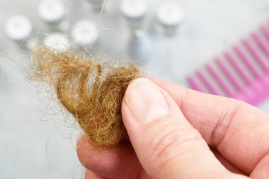 Saç dökülme problemi. İlaç şişeleri, saç fırçası ve saç topuzu. Alternatif tedaviler ilaç şişeleri ve gri arka planda tarak